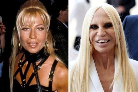 versace owner donatella|donatella versace before and after.